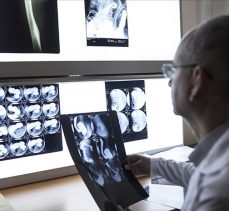 Meme kanserinde ‘mamografi’ hayat kurtarıyor