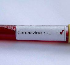 ABD’de ikinci kez Kovid-19’a yakalanan gençteki virüsün genetik dizilimi farklı çıktı